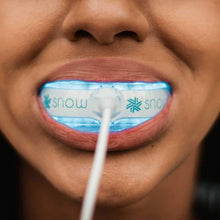 Load image into Gallery viewer, Snow Teeth Whitening™ - **SNOW-OFFER**