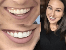 Load image into Gallery viewer, Floyd Mayweather's Snow Teeth Whitening™ At-Home System [All-in-One Kit]

